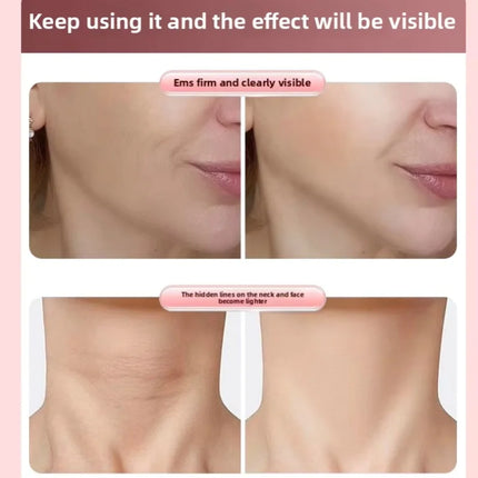 EMS Microcurrent Roller Face-Slimming Artifact V-Face Beauty Facial Massager for Firming and Lifting the Face